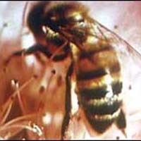 Tin tức trong ngày - Cứu sống bé 4 tuổi bị ong vò vẽ đốt 110 nốt