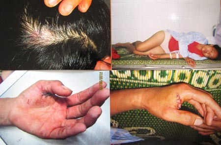 Đoạn tình, cả nhà chém con gái nuôi - 2