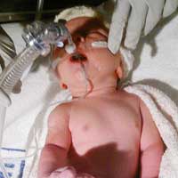 Sức khỏe đời sống - Bệnh lạ: Bé gái có tim bên phải