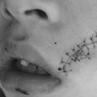 Sức khỏe đời sống - Khâu 38 mũi vì lon Pepsi phát nổ