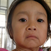 Tin tức trong ngày - Cháu bé 3 tuổi có khuôn mặt như bà già 60