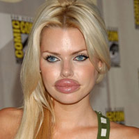 Thẩm mỹ viện - Đôi môi khiến phái mạnh "chạy mất dép"