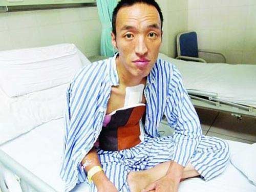 Lạ kỳ người đàn ông có máu tím - 1