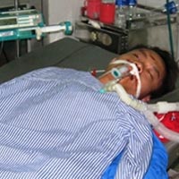 Sức khỏe đời sống - Nhập viện cấp cứu vì quá... "sung"