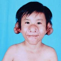 Sức khỏe đời sống - Việt Nam xuất hiện nhiều bệnh kỳ lạ khó chữa