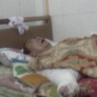 Pháp luật - Tình cảnh của người bị vợ "tắm" nước sôi