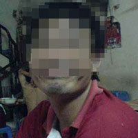 Sức khỏe đời sống - Nhập viện nắn "kiếm" vì hành sự phá cách