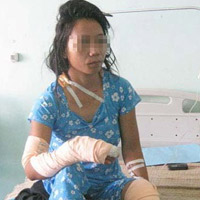 Pháp luật - Bị chồng đánh tàn tệ vì không biết ân ái