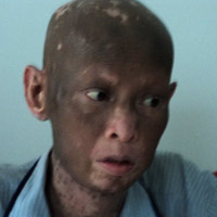 Tin tức trong ngày - Bệnh lạ khiến một người sụt 40kg, lột da