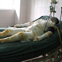 Pháp luật - Hất xăng thiêu 11 người: mẹ hung thủ đã chết