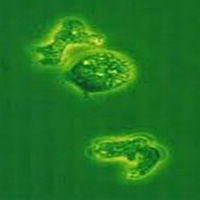 Tin tức trong ngày - Thêm một bé trai tử vong do amip ăn não?