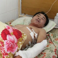 Pháp luật - Đang chạy xe, bỗng “dính” đạn xuyên ngực