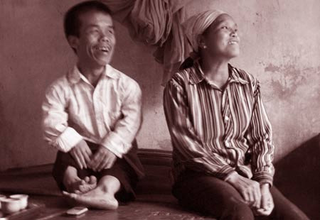 Thiên tình kỳ diệu của chú lùn ở Hà Nội - 2