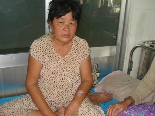 Hoảng loạn vì bị ong mặt quỷ tấn công - 2