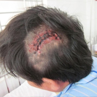 Pháp luật - Chém người tàn bạo tại Nghệ An