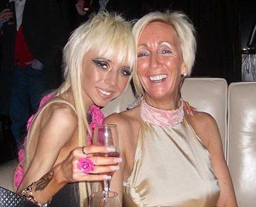 Hết chứng biếng ăn nhờ bị... xe đâm - 3