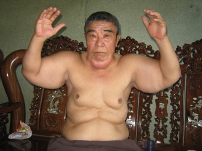 Ông cựu binh... mặc váy - 3