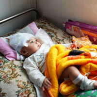 Sức khỏe đời sống - Cứu sống bé gái 6 tháng tuổi ngã lún sọ nặng