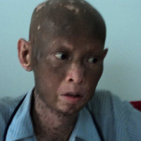 Tin tức trong ngày - Vụ người sút 40kg, lột da: Tìm ra "thủ phạm"