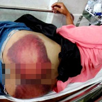 Pháp luật - Tin tiếp vụ nhập viện sau khi rời trụ sở CA