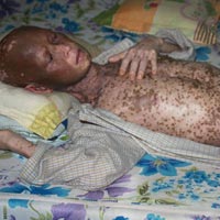 Sức khỏe đời sống - Đáng sợ ký sinh trùng chó, mèo