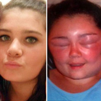 Thẩm mỹ viện - Nhuộm tóc, cô gái trông như "quái vật"