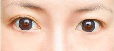 “Hô biến” mặt tròn thành trái xoan - 4