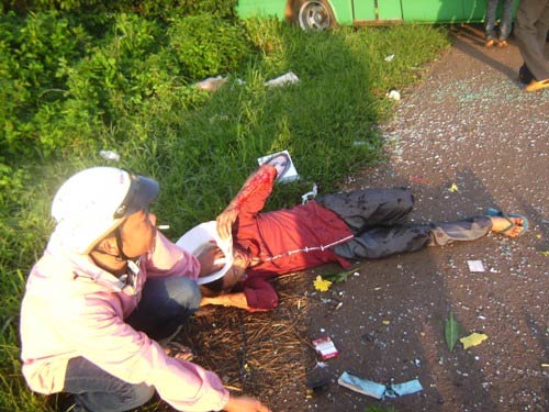 Xe container đâm xe bus, 5 người trọng thương - 2