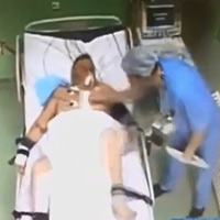 Sức khỏe đời sống - Bác sĩ đấm vào ngực bệnh nhân vừa mổ tim