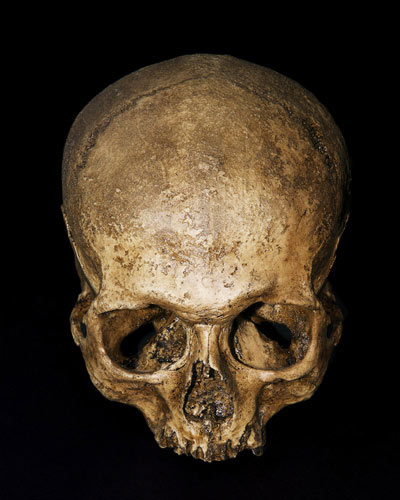 Phương pháp chữa bệnh ghê rợn nhất lịch sử - 3