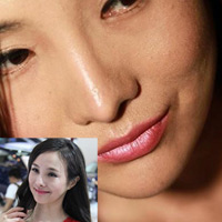 Làm đẹp - Gan Lu Lu sở hữu làn da sần sùi!