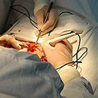 Sức khỏe đời sống - Bơm silicon biến “của quý” thành “của nợ”