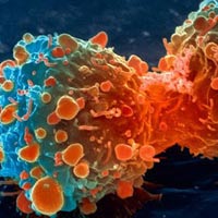 Sức khỏe đời sống - Đột phá trong chữa bệnh ung thư