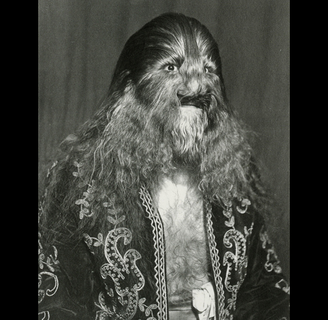 Stenphan Bibrowski (1891-1932) được biết đến nhiều hơn với cái tên Lionel hay Người đàn ông mang mặt sư tử, là một nghệ sĩ biểu diễn nổi tiếng. Toàn bộ cơ thể của ông bị bao trùm bởi bộ lông dài khiến ông trông như một con sư tử.