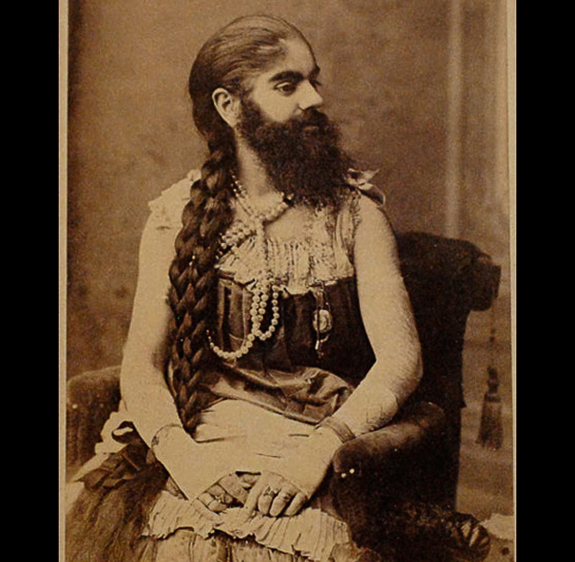 Annie Jones (khoảng 1860 – 1902) là một người phụ nữ Mỹ có râu mép, sinh ra ở Virginia. Sinh thời, bà đã đi biểu diễn lưu động với nghệ sĩ biểu diễn P.T.Barnum trong đoàn xiếc của ông này. 