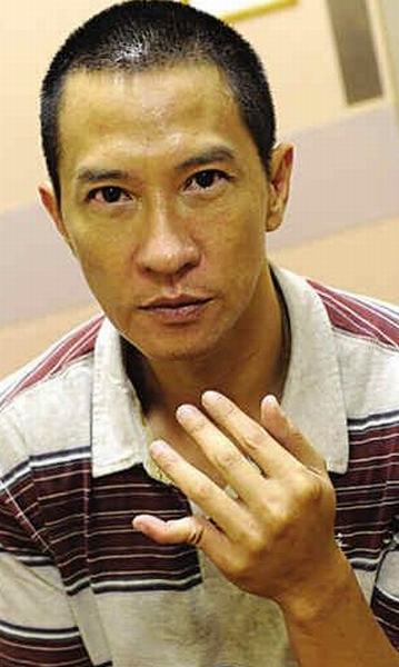 Trương Gia Huy đứt lìa ngón tay vì quyền anh - 8