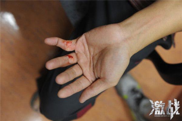 Trương Gia Huy đứt lìa ngón tay vì quyền anh - 9