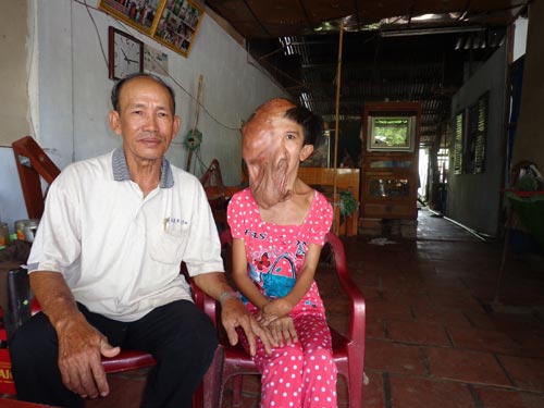 Cô gái có mũi, tai, miệng... chảy xuống ngực - 2