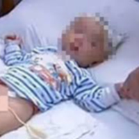 Sức khỏe đời sống - Bé 16 tháng tuổi bị chó nhà cắn rách mặt