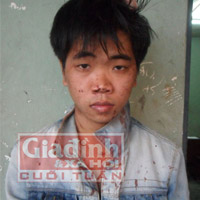 Pháp luật - Thiếu úy CA kể giây phút bị côn đồ bắn