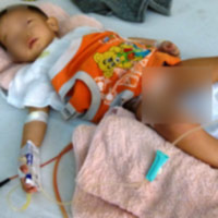 Sức khỏe đời sống - Bé bị cắt nhầm bàng quang về lại Khánh Hòa điều trị