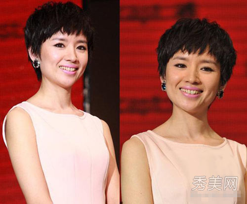 Hàm răng ố vàng của mỹ nhân giải trí - 2