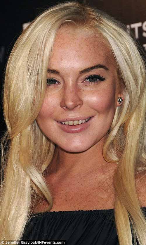 Hàm răng ố vàng của mỹ nhân giải trí - 7