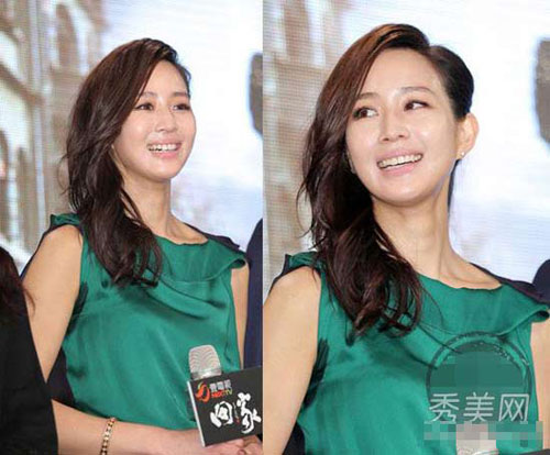 Hàm răng ố vàng của mỹ nhân giải trí - 4