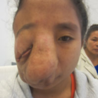 Sức khỏe đời sống - Giáo sư Mỹ ra tay cứu 2 bệnh nhân bị biến dạng mặt