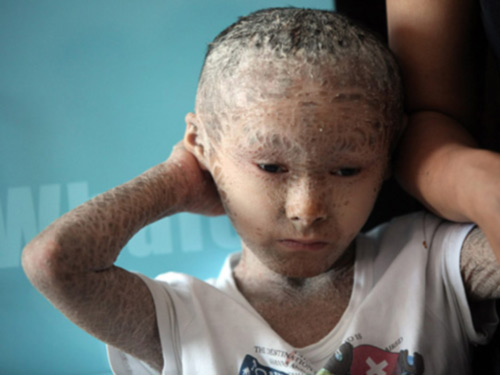 Thương tâm cậu bé "người cá" - 2