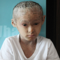 Sức khỏe đời sống - Thương tâm cậu bé "người cá"