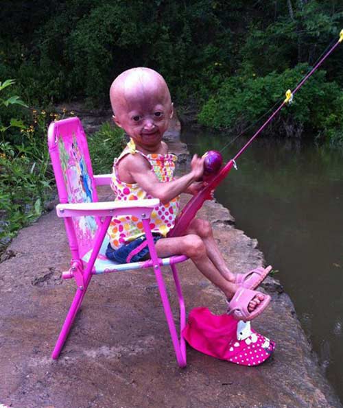 Bé gái 6 tuổi thân thể bà già - 4