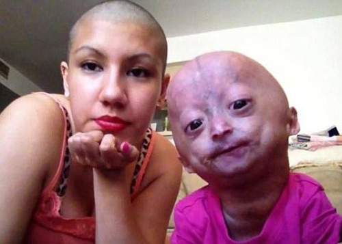 Bé gái 6 tuổi thân thể bà già - 2