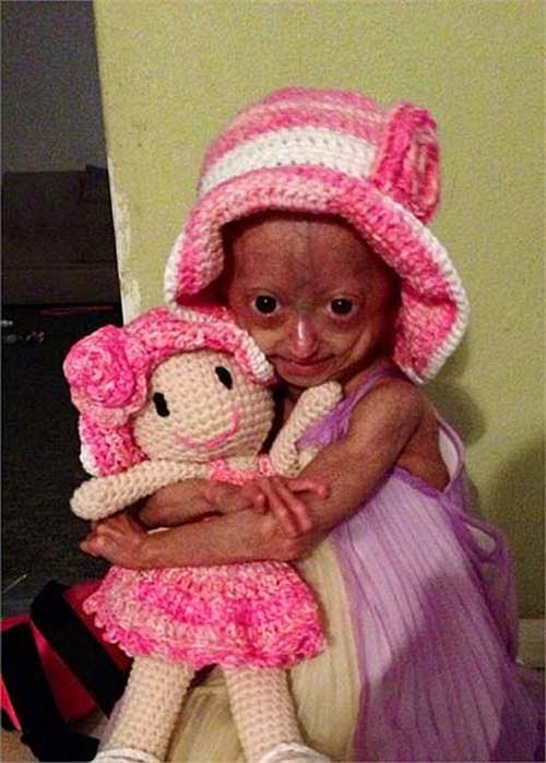 Bé gái 6 tuổi thân thể bà già - 5